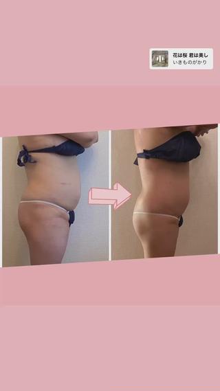 痩身リラク専門サロン 〜LUCIALL 〜のエステ・リラクイメージ