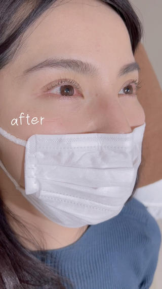 まつ毛パーマ、before▷after 