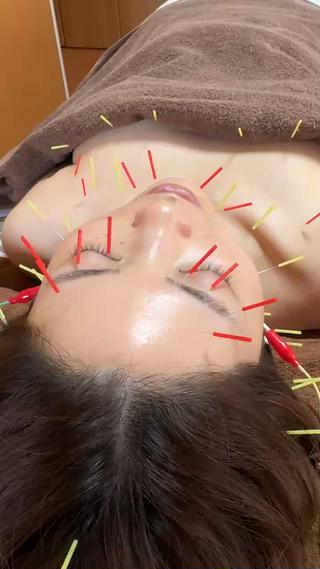 美容鍼・脱毛サロン Callaのエステ・リラクイメージ