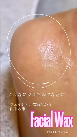 フェイシャル Wax脱毛＋ぷるぷるパック

細かい産毛を綺麗にキャッチします
血行促進する事でターンオーバーUP
角質除去
綺麗な眉
お化粧のノリがよくなる
続けていただく事で産毛も生えづらくなります

ESPOIR nocoのフェイシャル Wax脱毛は細かくWax剤を塗って剥がしていきます
お顔のお肌はとてもデリケートなので！
ここがとても大切になります♡

Wax脱毛後はお肌のお手入れをしっかりとしてくださいませ。
※保水が大切となります。（油分は禁止） 
