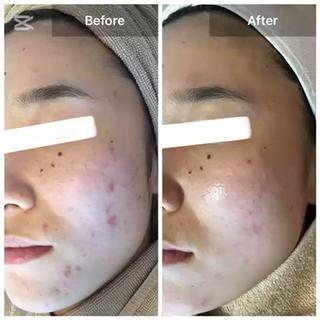 ハーブピーリング 専門店MOKA所属・ハーブピーリング専門 MOKAのエステ・リラクイメージ