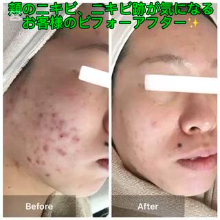 ハーブピーリング 専門店MOKA所属・ハーブピーリング専門 MOKAのエステ・リラクイメージ