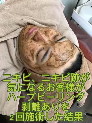 ハーブピーリング 専門店MOKA所属・ハーブピーリング専門 MOKAのエステ・リラクイメージ