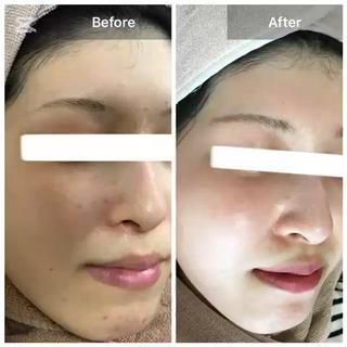 ハーブピーリング 専門店MOKA所属・ハーブピーリング専門 MOKAのエステ・リラクイメージ