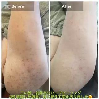 ハーブピーリング 専門店MOKA所属・ハーブピーリング専門 MOKAのエステ・リラクイメージ