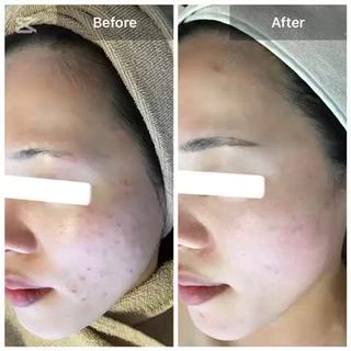 ハーブピーリング 専門店MOKA所属・ハーブピーリング専門 MOKAのエステ・リラクイメージ