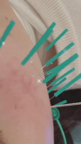 小顔美容鍼専門サロン 渋谷YZのエステ・リラクイメージ