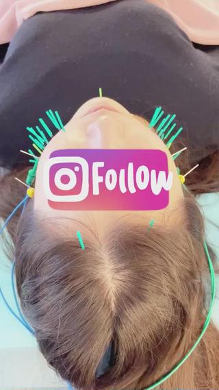 小顔美容鍼専門サロン 渋谷YZのエステ・リラクイメージ