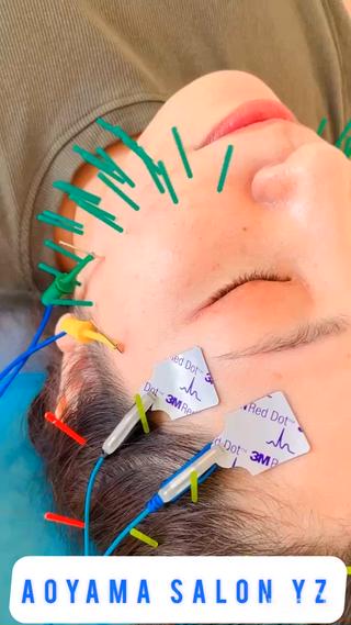 小顔美容鍼専門サロン 渋谷YZのエステ・リラクイメージ