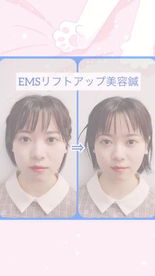 小顔美容鍼専門サロン 渋谷YZのエステ・リラクイメージ