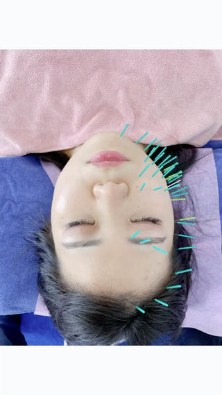 小顔美容鍼専門サロン 渋谷YZのエステ・リラクイメージ