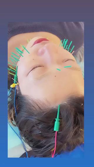 小顔美容鍼専門サロン 渋谷YZのエステ・リラクイメージ