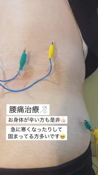 美容鍼/鍼灸 ここみ鍼灸院のエステ・リラクイメージ