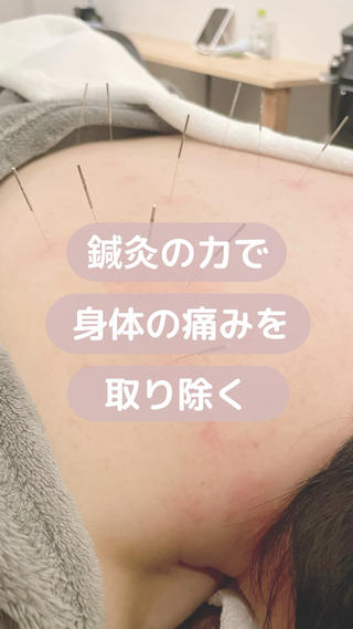 美容鍼/鍼灸 ここみ鍼灸院のエステ・リラクイメージ