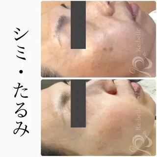 ハーブピーリング専門 BIOEL横浜のエステ・リラクイメージ