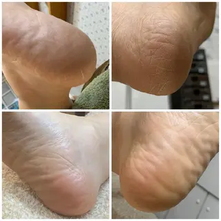 carenail　 tsugumiのその他イメージ