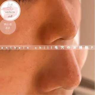アンテインチル 山本のエステ・リラクイメージ