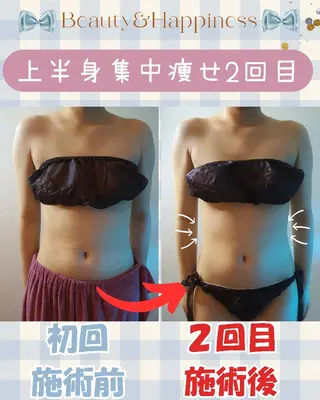 痩身ハーブピーリング 筋膜リリース☆B&Hのエステ・リラクイメージ