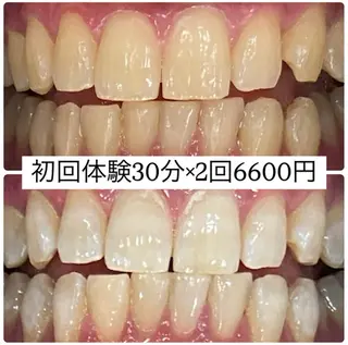 PLATINUM Beauty 横浜店所属・ホワイトニングルーム 横浜店のその他イメージ