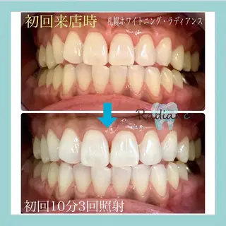 札幌ホワイトニング ラディアンス札幌駅店のその他イメージ