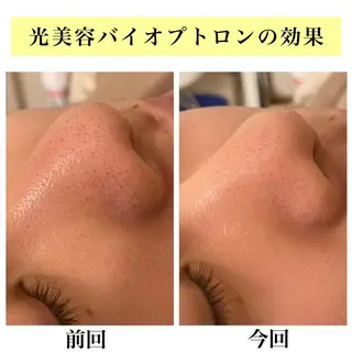 Bellesthe (ベルエステ)のエステ・リラクイメージ