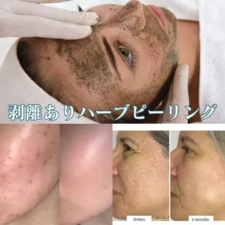 BestBelleꕤ 大阪福島/肌質改善のエステ・リラクイメージ