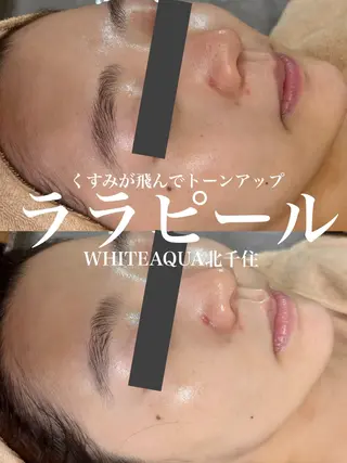 WHITE AQUA 北千住店のエステ・リラクイメージ