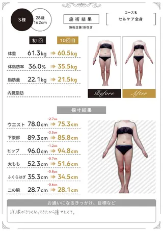 キレイサローネ 自由が丘✨全身痩身のエステ・リラクイメージ