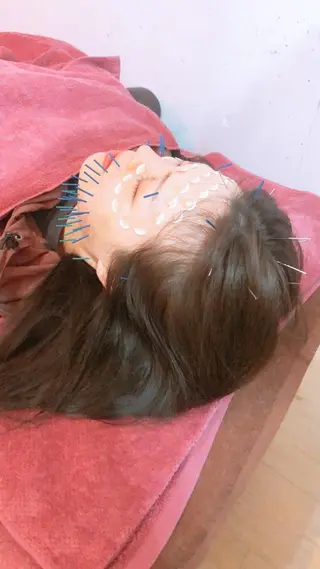 美容鍼灸女性専用 りんご鍼灸治療院のその他イメージ