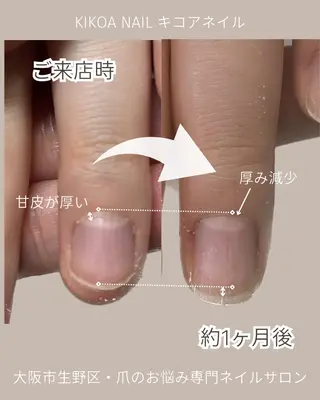 ネイル KIKOA NAIL キコアネイルのネイルデザイン
