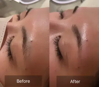 アイブロウ for woman所属・森 美優のエステ・リラクイメージ