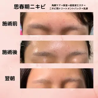 ミューズエステ 谷口美結のエステ・リラクイメージ