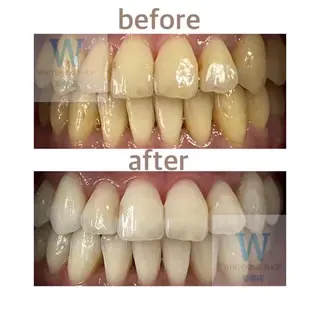 ホワイトニング ショップ船橋店のエステ・リラクイメージ