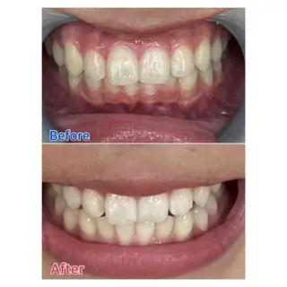 MBEAUTYSALON 千葉店・京成大久保所属・Melty 輝のその他イメージ