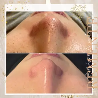 CHARMER韓国式美肌サロン所属・CHARMER🌹 Naokoの眉毛・アイブロウイメージ