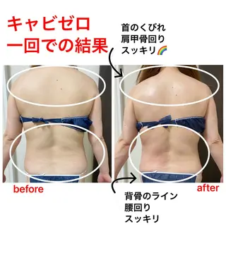 ダイエット／脱毛 美顔／フォト／ハーブのその他イメージ