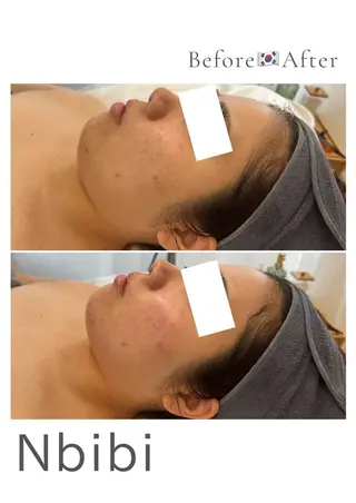 韓国🇰🇷価格 サロン_Nbibiのエステ・リラクイメージ