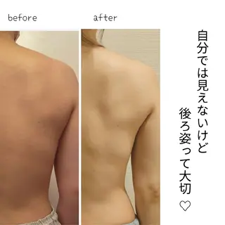 ブロッサム那覇店所属・自分のための筋膜 ﾘﾘｰｽ(Shey)のエステ・リラクイメージ