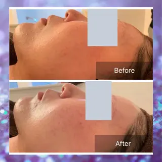 Lumiere despoir所属・Lumiere despoirのエステ・リラクイメージ