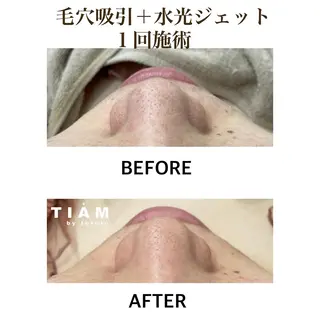 美肌サロンTIAM by tetoteのエステ・リラクイメージ