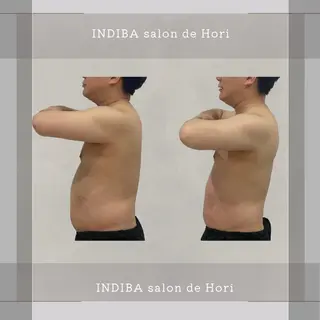 メンズ INDIBA Salon小澤るいのエステ・リラクイメージ