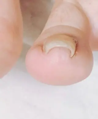 ネイル 北浦和 自爪育成ケアのネイルデザイン