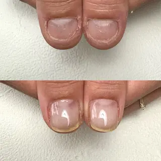 ネイル 自爪育成サロン Ka Pilinaのネイルデザイン