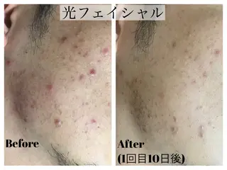 LiZA エステティックサロンのエステ・リラクイメージ