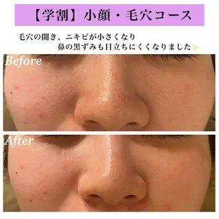 Bellesthe (ベルエステ)のエステ・リラクイメージ