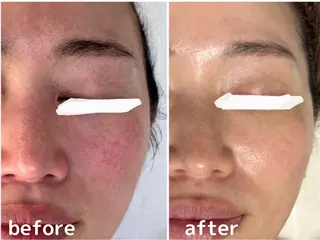 田中For..天王寺 肌質改善/よもぎ蒸しのエステ・リラクイメージ