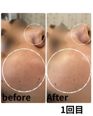 Astorie 相模大野エステのその他イメージ