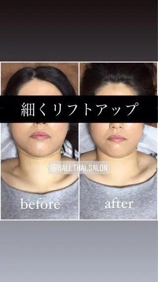 🌈歪み改善🌈 バリンタイ すぎうらのエステ・リラクイメージ