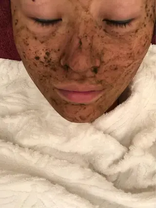 FLEUR大阪・美容 整体・痩身・小顔のエステ・リラクイメージ