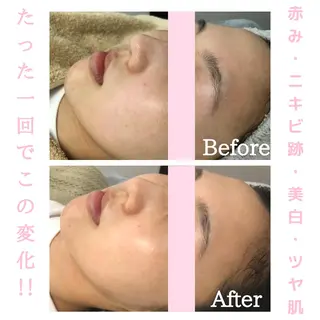 BestBelleꕤ 大阪福島/肌質改善のエステ・リラクイメージ